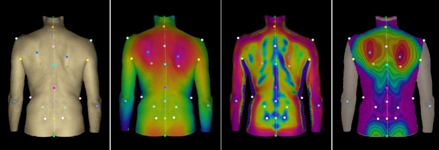 Le immagini acquisite con il sistema Surfacer rappresentano, da sinistra: la fotografia (l’aspetto naturale), la mappa di profondità a falsi colori, la curvatura media e la mappa di profondità normalizzata. Sopra le immagini sono stati indicati i principali punti diagnostici. (Immagine: AILUN)